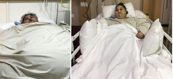 Egypte / Inde : La plus grosse femme du monde perd 323 kilos après une opération